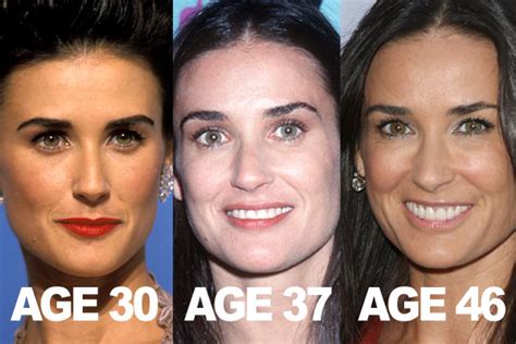 does demi moore have implants.